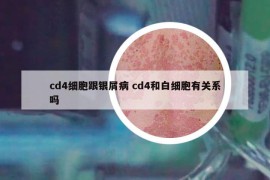 cd4细胞跟银屑病 cd4和白细胞有关系吗