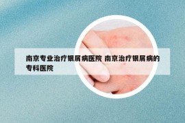 南京专业治疗银屑病医院 南京治疗银屑病的专科医院