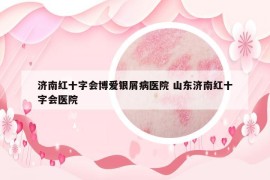 济南红十字会博爱银屑病医院 山东济南红十字会医院