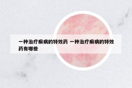 一种治疗癣病的特效药 一种治疗癣病的特效药有哪些