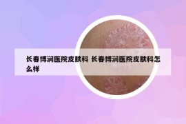 长春博润医院皮肤科 长春博润医院皮肤科怎么样