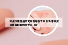 郑州市银屑病研究所有哪些专家 郑州市银屑病研究所有哪些专家门诊