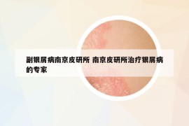 副银屑病南京皮研所 南京皮研所治疗银屑病的专家