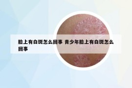 脸上有白斑怎么回事 青少年脸上有白斑怎么回事
