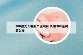 308激光长春那个医院有 长春308医院怎么样