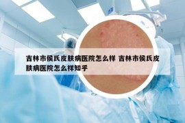 吉林市侯氏皮肤病医院怎么样 吉林市侯氏皮肤病医院怎么样知乎