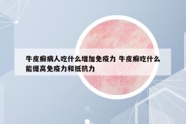 牛皮癣病人吃什么增加免疫力 牛皮癣吃什么能提高免疫力和抵抗力