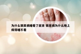 为什么银屑病睡着了就青 银屑病为什么晚上痒得睡不着