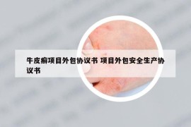 牛皮癣项目外包协议书 项目外包安全生产协议书