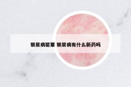 银屑病罂粟 银屑病有什么新药吗