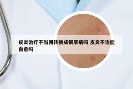 皮炎治疗不当回转换成银屑病吗 皮炎不治能自愈吗