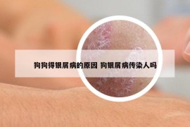 狗狗得银屑病的原因 狗银屑病传染人吗