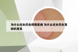 为什么吃补药会得很屑病 为什么吃补药头发掉的更多