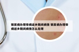 银屑病办理带病返乡期间病情 银屑病办理带病返乡期间病情怎么处理