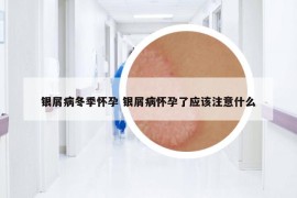 银屑病冬季怀孕 银屑病怀孕了应该注意什么