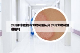 郑州那家医院有生物制剂拓资 郑州生物制剂报销吗