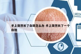 手上突然长了白斑怎么办 手上突然长了一个白斑