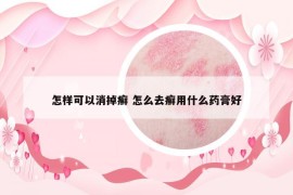 怎样可以消掉癣 怎么去癣用什么药膏好