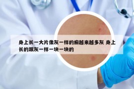 身上长一大片像灰一样的癣越来越多灰 身上长的跟灰一样一块一块的