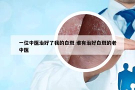 一位中医治好了我的白斑 谁有治好白斑的老中医