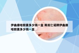 伊曲康唑胶囊多少钱一盒 斯皮仁诺牌伊曲康唑胶囊多少钱一盒