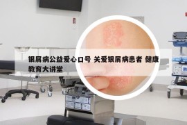 银屑病公益爱心口号 关爱银屑病患者 健康教育大讲堂