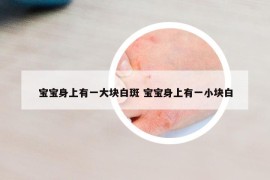 宝宝身上有一大块白斑 宝宝身上有一小块白