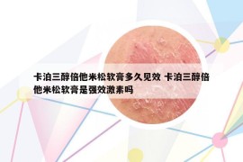 卡泊三醇倍他米松软膏多久见效 卡泊三醇倍他米松软膏是强效激素吗