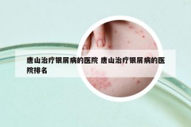 唐山治疗银屑病的医院 唐山治疗银屑病的医院排名