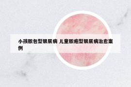 小孩脓包型银屑病 儿童脓疱型银屑病治愈案例