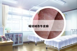 暗访城市牛皮癣