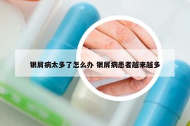 银屑病太多了怎么办 银屑病患者越来越多