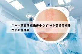 广州中医银屑病治疗中心 广州中医银屑病治疗中心在哪里