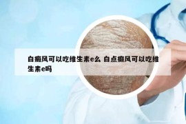 白癜风可以吃维生素e么 白点癫风可以吃维生素e吗