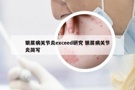 银屑病关节炎exceed研究 银屑病关节炎简写