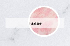 牛皮癣患者
