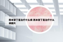 西米替丁是治疗什么病 西米替丁是治疗什么病图片