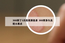 308照了3次出现黑色素 308照多久出现小黑点