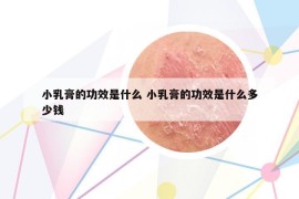 小乳膏的功效是什么 小乳膏的功效是什么多少钱