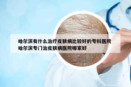 哈尔滨有什么治疗皮肤病比较好的专科医院 哈尔滨专门治皮肤病医院哪家好
