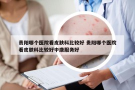 贵阳哪个医院看皮肤科比较好 贵阳哪个医院看皮肤科比较好中康服务好