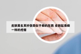 皮肤莫名其妙张类似于癣的东西 皮肤起像癣一样的疙瘩