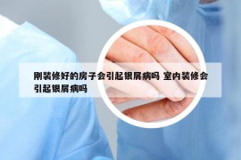 刚装修好的房子会引起银屑病吗 室内装修会引起银屑病吗