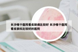 长沙哪个医院看皮肤病比较好 长沙哪个医院看皮肤科比较好的医院
