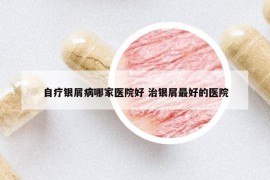 自疗银屑病哪家医院好 治银屑最好的医院