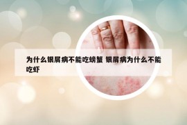 为什么银屑病不能吃螃蟹 银屑病为什么不能吃虾