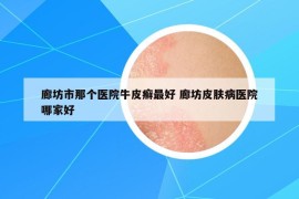 廊坊市那个医院牛皮癣最好 廊坊皮肤病医院哪家好