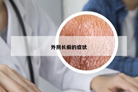 外阴长癣的症状