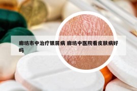 廊坊市中治疗银屑病 廊坊中医院看皮肤病好吗