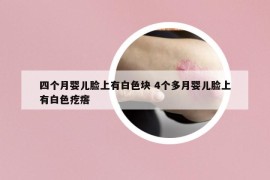 四个月婴儿脸上有白色块 4个多月婴儿脸上有白色疙瘩